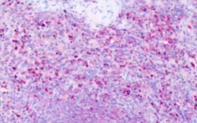 Immunohistochemistry-Paraffin: Histamine H1R Antibody [NBP3-14373]